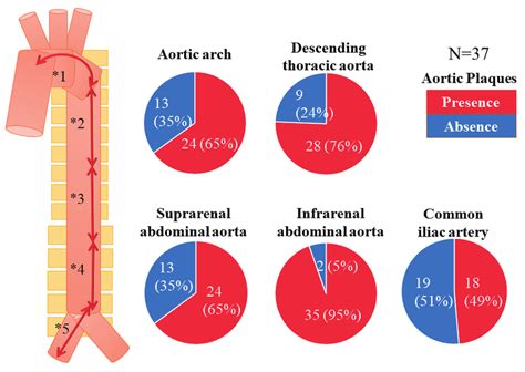 Translate atherosclerotic aorta in Tagalog with examples.